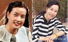 阿佳妮整容前